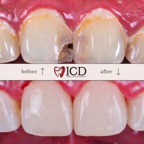 Restorative 1