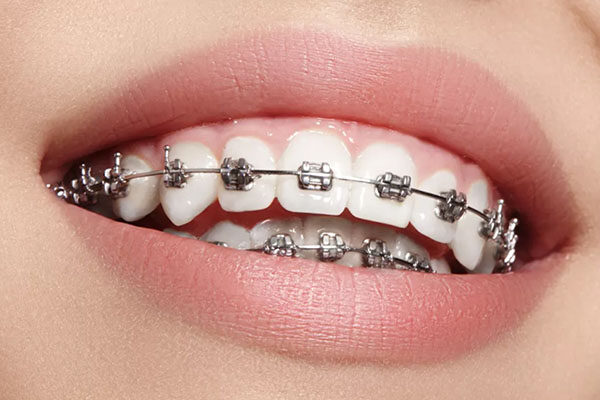 layanan dental - ICD Indonesia Clinic & Dental - 1