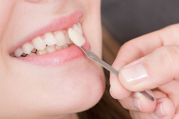 layanan dental - ICD Indonesia Clinic & Dental - 3
